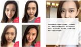 鄭州全切雙眼皮多少錢