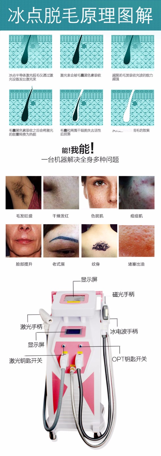 OPT激光射頻黑臉娃娃一體機免費培訓