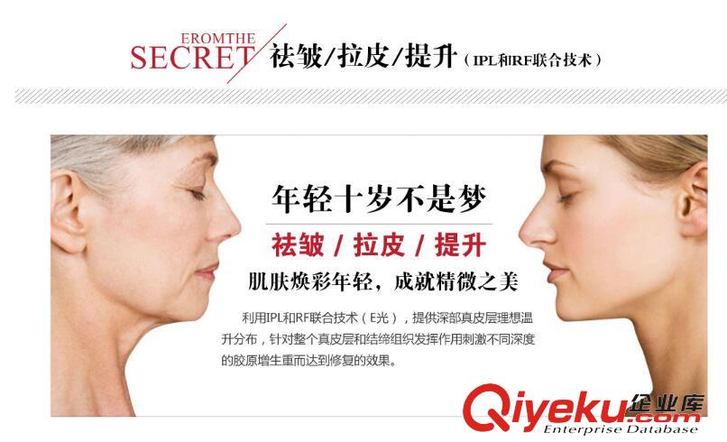 光子嫩膚儀廠家排行榜，美容院光子嫩膚儀廠家直銷
