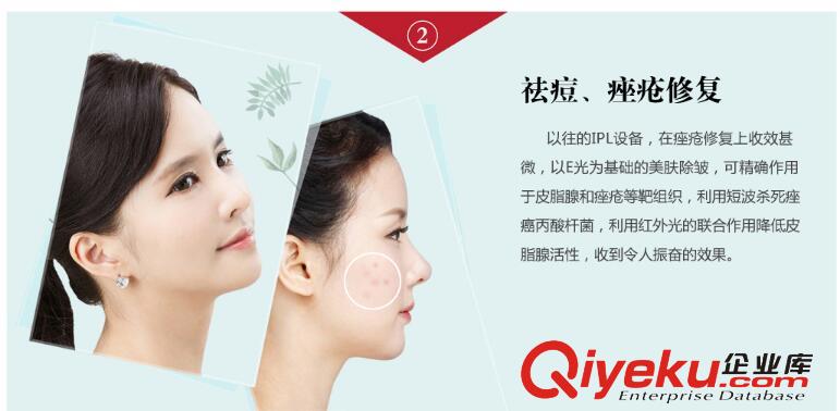 光子嫩膚儀器排行榜，美容院光子嫩膚儀器排行榜原始圖片2