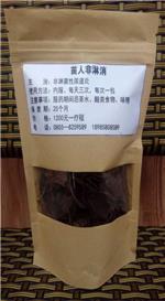 非淋菌性尿道炎xx大概多少钱